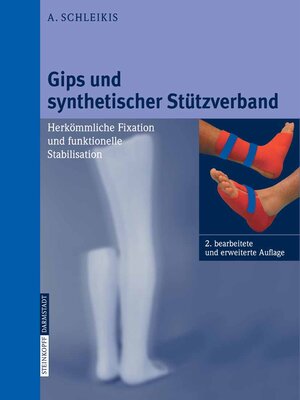 cover image of Gips und synthetischer Stützverband
